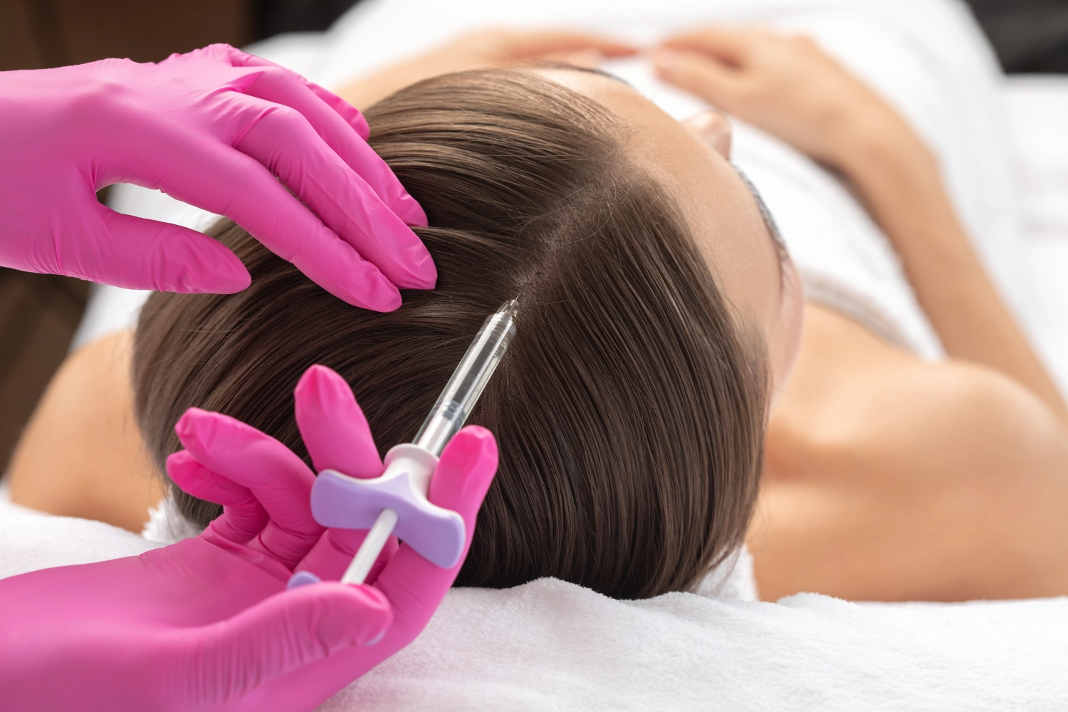 Injektionstherapie gegen Haarausfall und Antischuppen in der Naturheilpraxis Coniglio